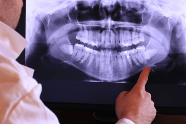 Best Tooth Pain Emergency Relief  in Eagle, ID